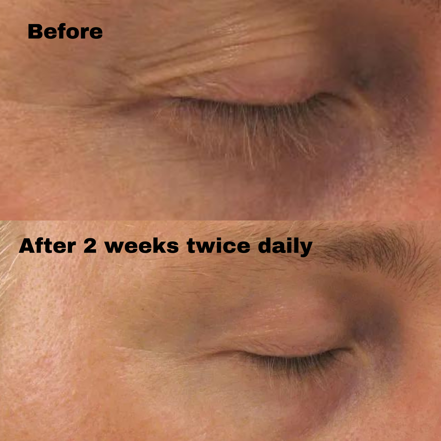 PCA SKIN® Ideal Complex® Revitalizing Eye Gel