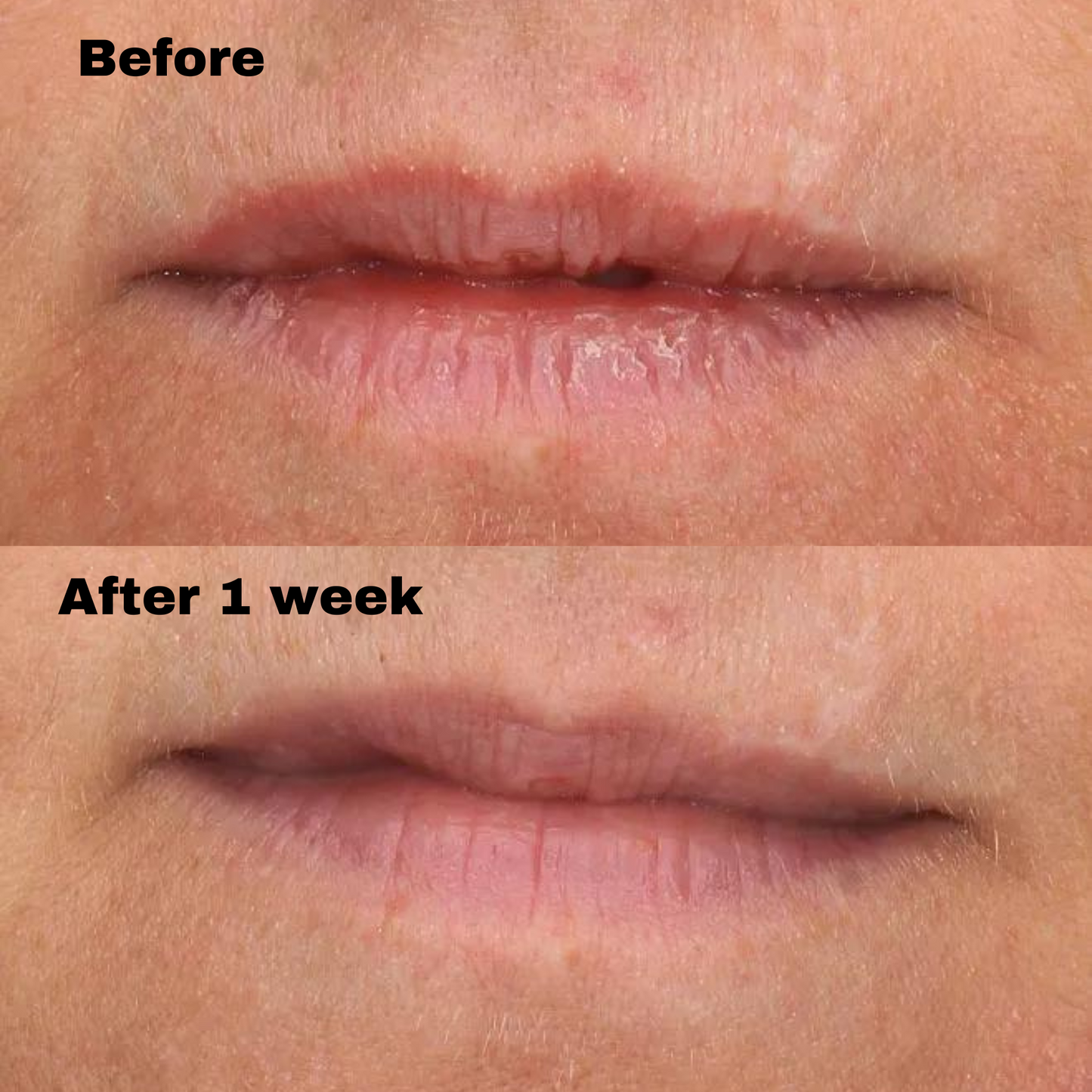 PCA SKIN® Overnight Lip Mask