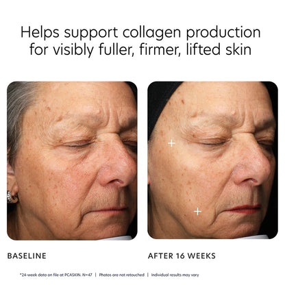 PCA SKIN MGF Age Renewal Cream