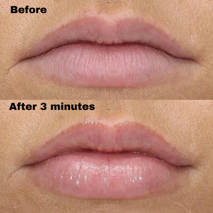 Hyaluronic Acid Lip Booster