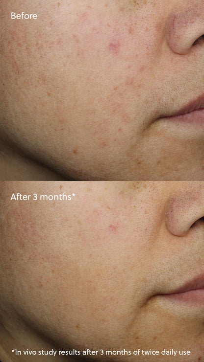 Eminence Vitamin C⁺ Serum
