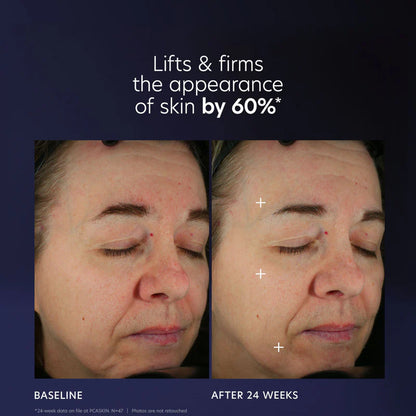 PCA SKIN Pro-Max Age Renewal