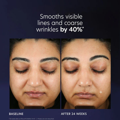 PCA SKIN Pro-Max Age Renewal