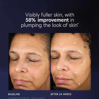 PCA SKIN Pro-Max Age Renewal